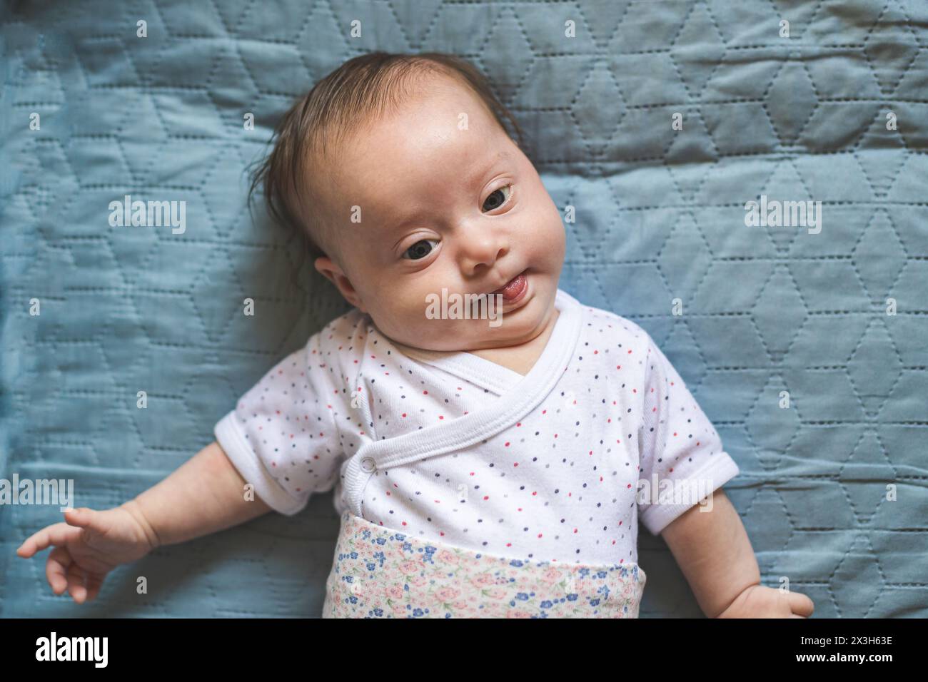 Bambina con la sindrome di Down che guarda la telecamera Foto Stock