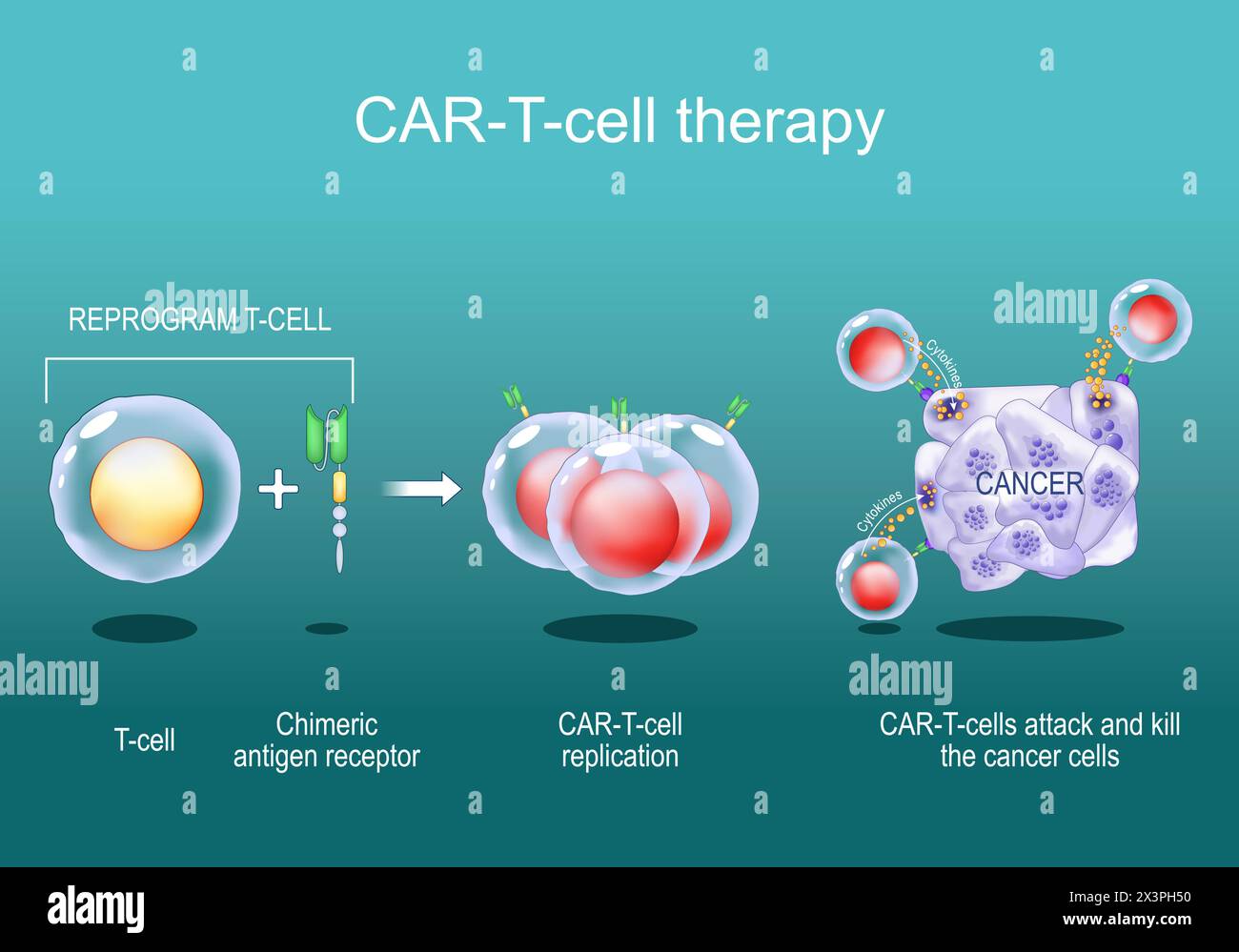 Terapia con cellule T DELL'AUTO. immunoterapia contro il cancro. uccisione di cellule tumorali. geneticamente modificato. Medicina personalizzata. Poster vettoriale. Illustrazione piatta isometrica Illustrazione Vettoriale