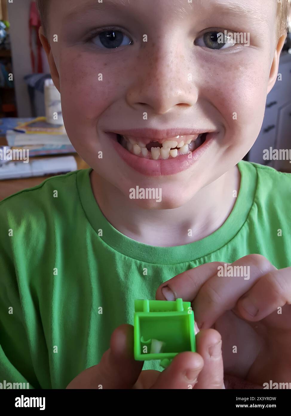 Un ragazzo gioioso con lentiggini mostra il sorriso senza denti e il dente perso Foto Stock