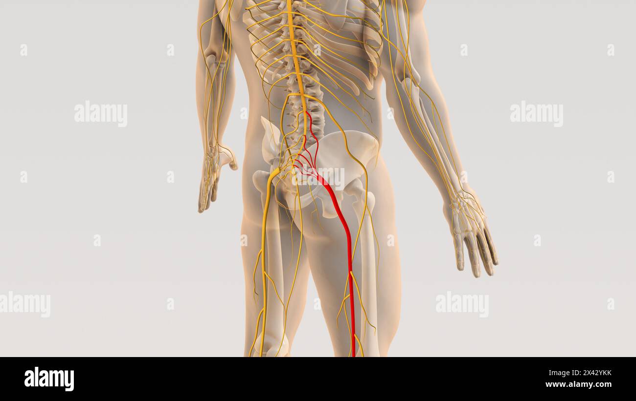 Sciatica colonna vertebrale e dolore nervoso concetto medico Foto Stock