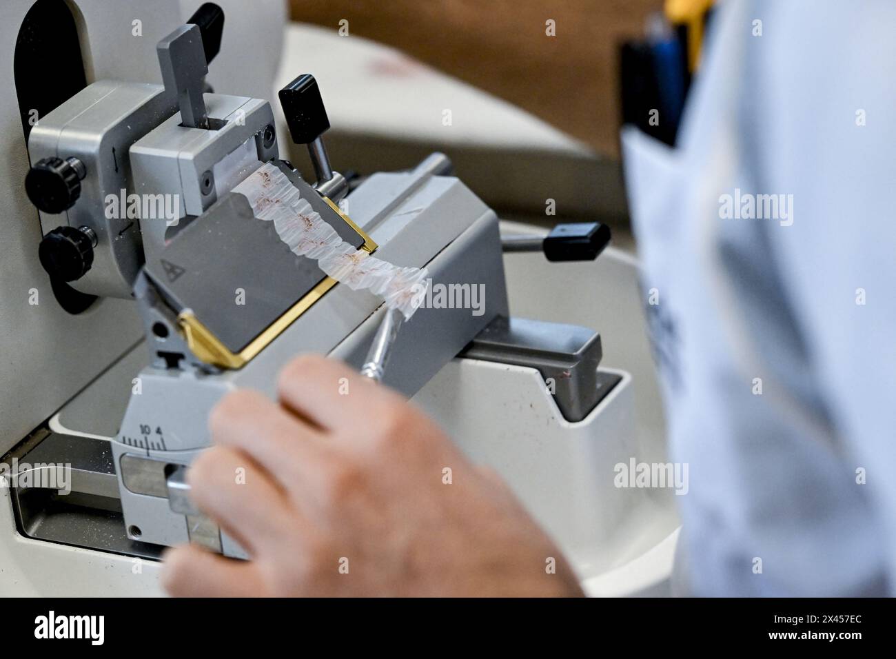 ATTENZIONE REDATTORI: EDITORIALE UTILIZZARE SOLO il reparto di patologia anatomica nell'ospedale Imelda di Bonheiden, giovedì 17 agosto 2023. BELGA FOTO DIRK WAEM Foto Stock