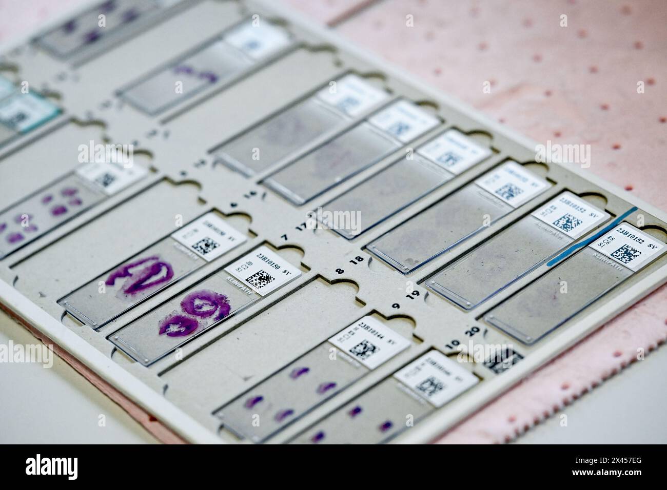 ATTENZIONE REDATTORI: EDITORIALE UTILIZZARE SOLO il reparto di patologia anatomica nell'ospedale Imelda di Bonheiden, giovedì 17 agosto 2023. BELGA FOTO DIRK WAEM Foto Stock