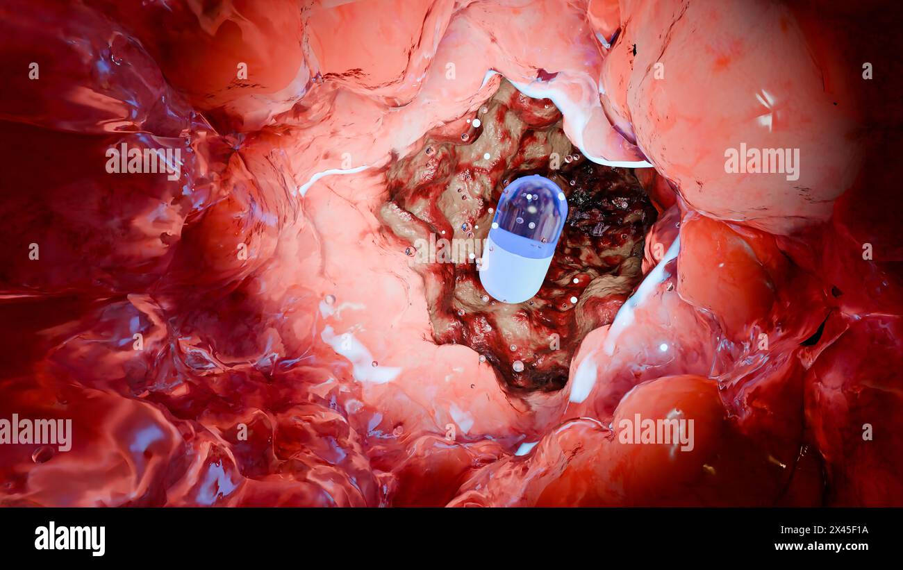 Probiotici nel tratto intestinale. endoscopia attraverso l'intestino. Microbiota, Capsula per pillole con vitamine per l'apparato digerente, trattamento del dolore allo stomaco, Rosso Foto Stock