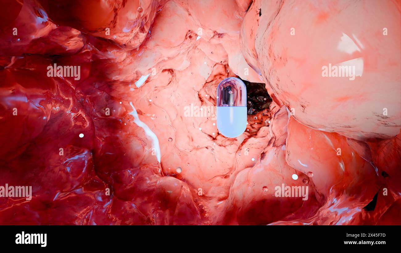 Probiotici nel tratto intestinale. endoscopia attraverso l'intestino. Microbiota, Capsula per pillole con vitamine per l'apparato digerente, trattamento del dolore allo stomaco, Rosso Foto Stock