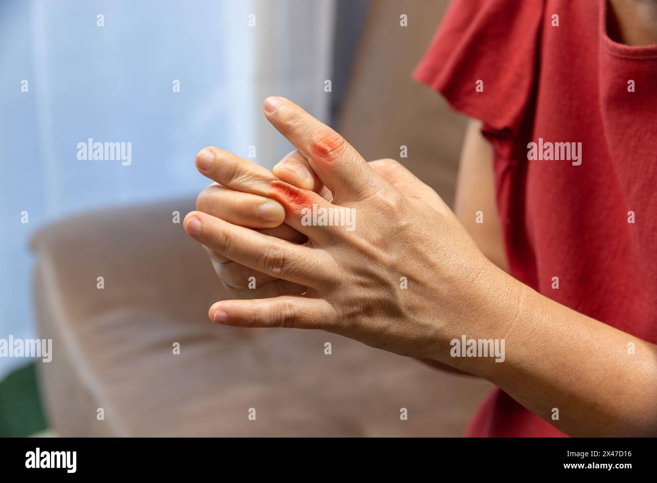 Senior Woman massaggio dito con gonfia dolorosa gotta Foto Stock