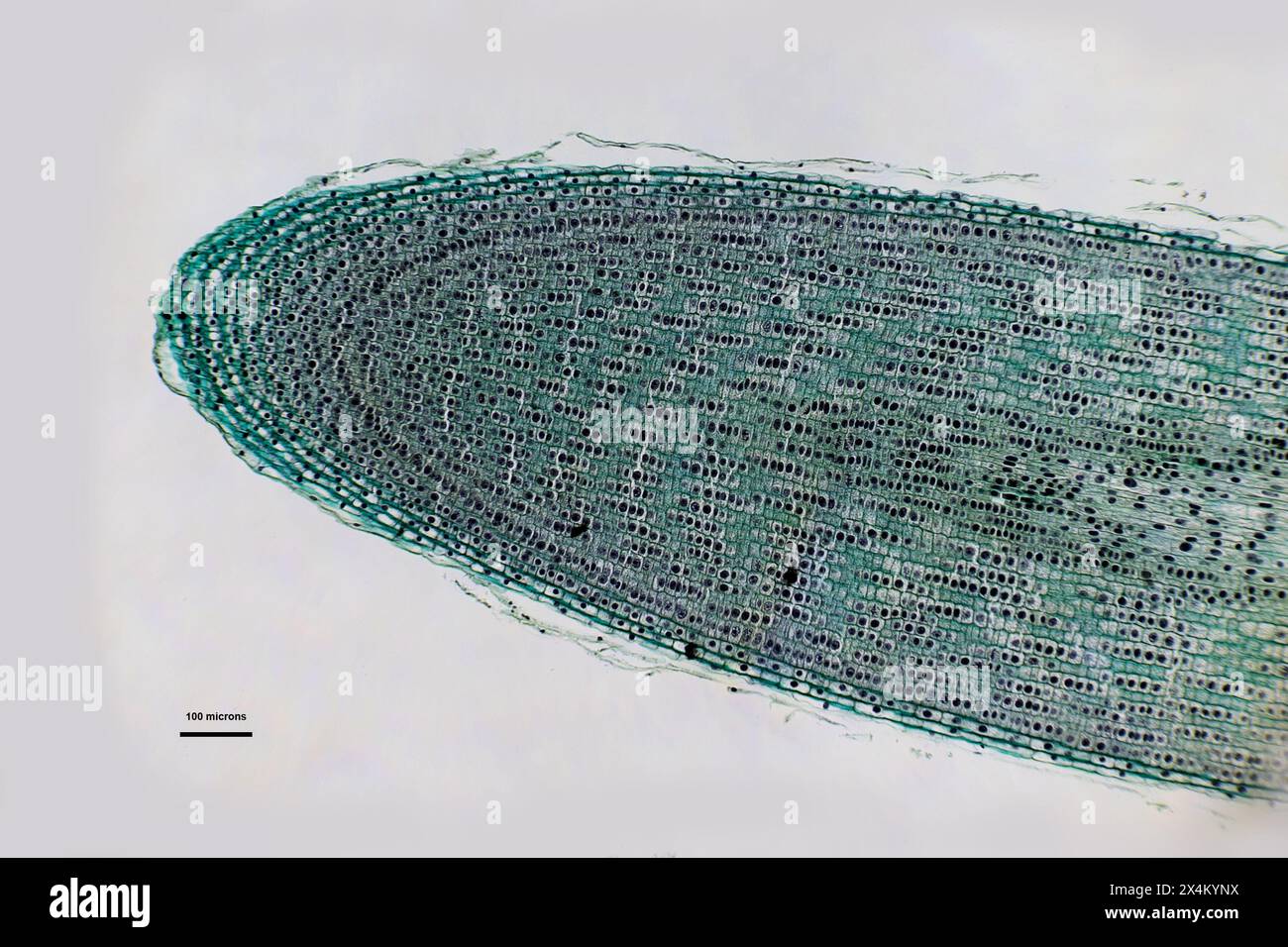 celle a cipolla sotto un microscopio leggero con ingrandimento 10 volte superiore Foto Stock