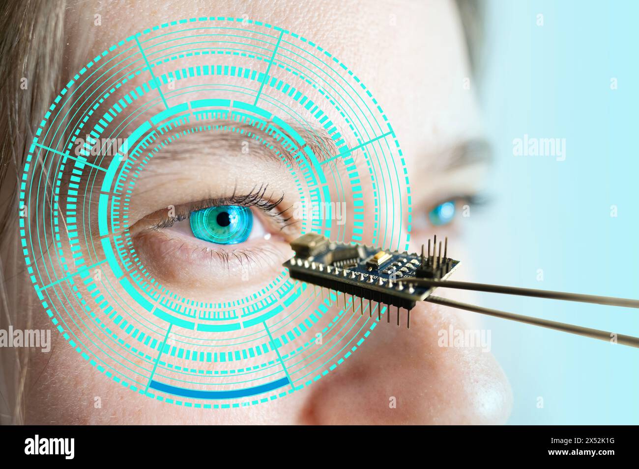 Installazione di chip elettronici in occhio bionico umano, neuroprotesico, tecnologia all'avanguardia, progresso tecnologico visionario, ripristinare la vista Foto Stock