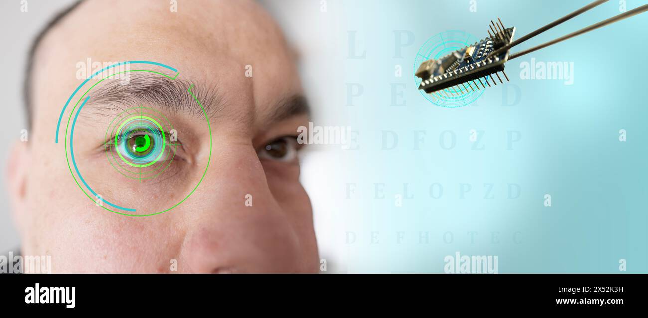Installazione di chip elettronici in occhio bionico, neuroprotesico umano, tecnologia all'avanguardia, progresso tecnologico visionario e visione futuristica Foto Stock