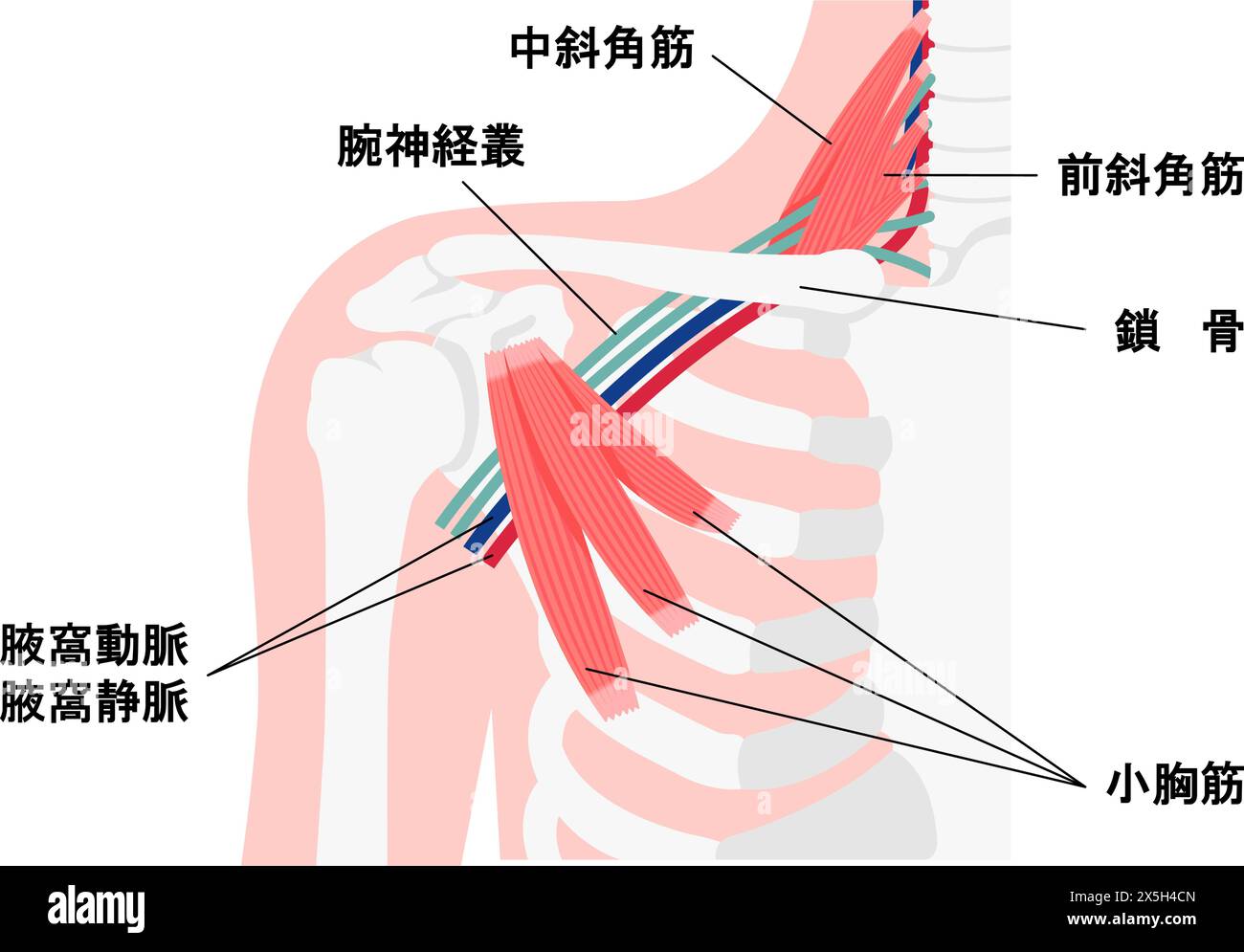 Illustrazione vettoriale di dove si verifica la sindrome dello sbocco toracico Illustrazione Vettoriale