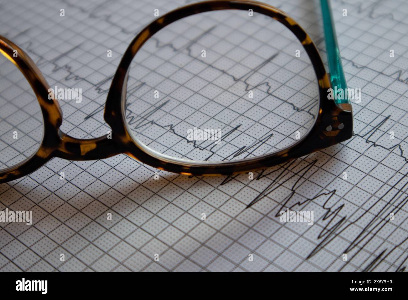 Referti ECG ECG ECG stampati su fogli. Un paio di occhiali da lettura Foto Stock