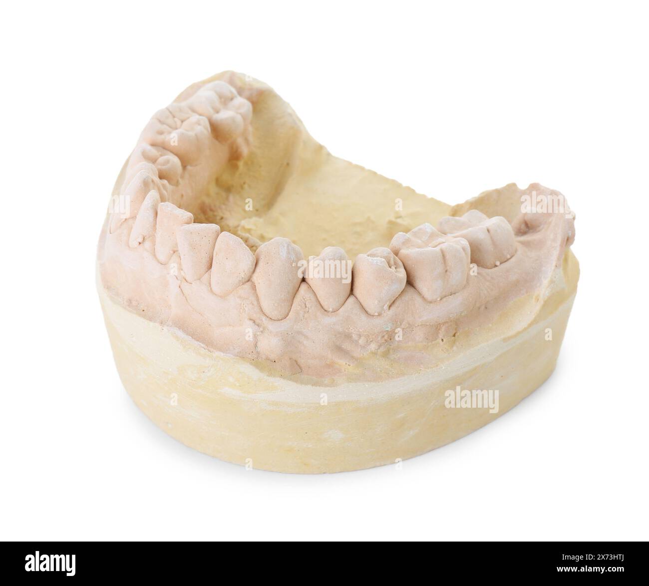Modello dentale con mascella isolata su bianco. Fusione di denti Foto Stock