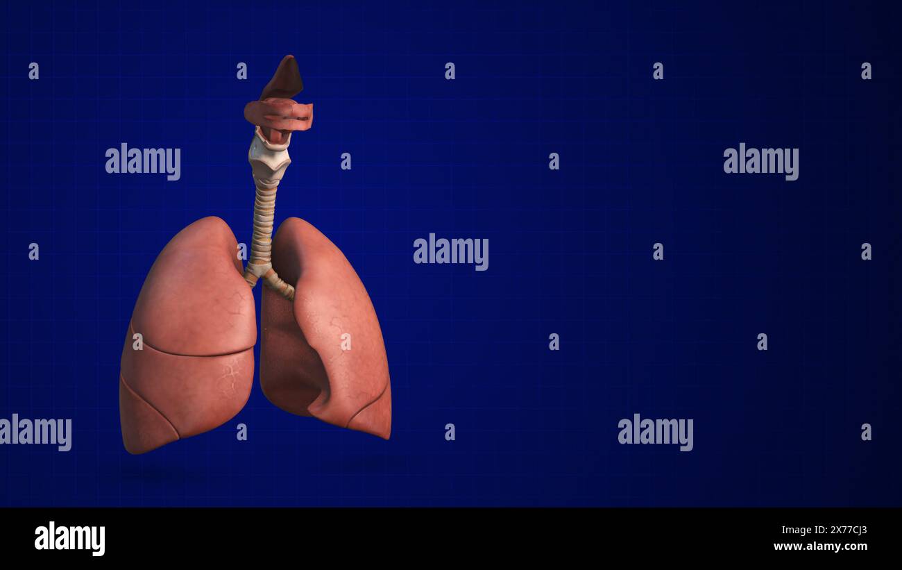 Infezione polmonare umana infiammazione respiratoria malattia Foto Stock