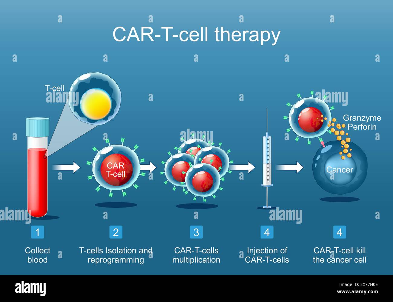 Terapia con cellule T DELL'AUTO. immunoterapia contro il cancro. uccisione di cellule tumorali. geneticamente modificato. Medicina personalizzata... Poster vettoriale. Immagine piatta isometrica Illustrazione Vettoriale
