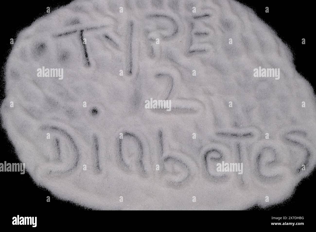 Il diabete mellito, spesso noto semplicemente come diabete, è un gruppo di malattie endocrine comuni caratterizzate da un elevato livello di zucchero nel sangue sostenuto!!! Foto Stock Il diabete mellito, spesso noto semplicemente come diabete, è un gruppo di malattie endocrine comuni caratterizzate da un elevato livello di zucchero nel sangue sostenuto!!! Foto Stock