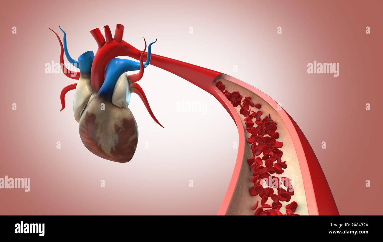 Arteria e sangue nel cuore umano Foto Stock