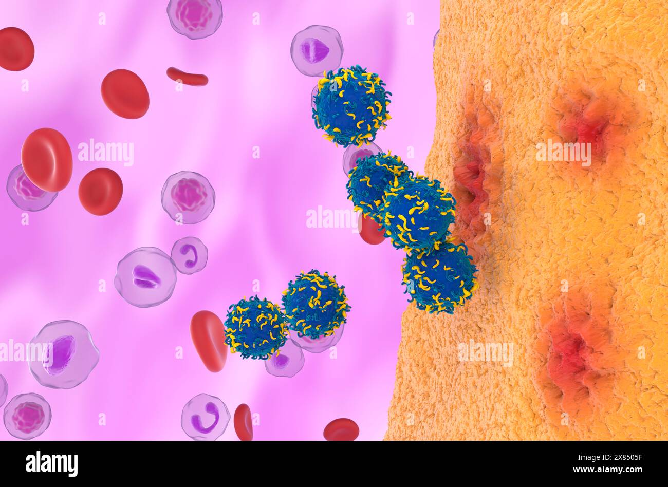 Terapia con cellule T di CAR nell'artrite reumatoide - Vista isometrica illustrazione 3d. Foto Stock