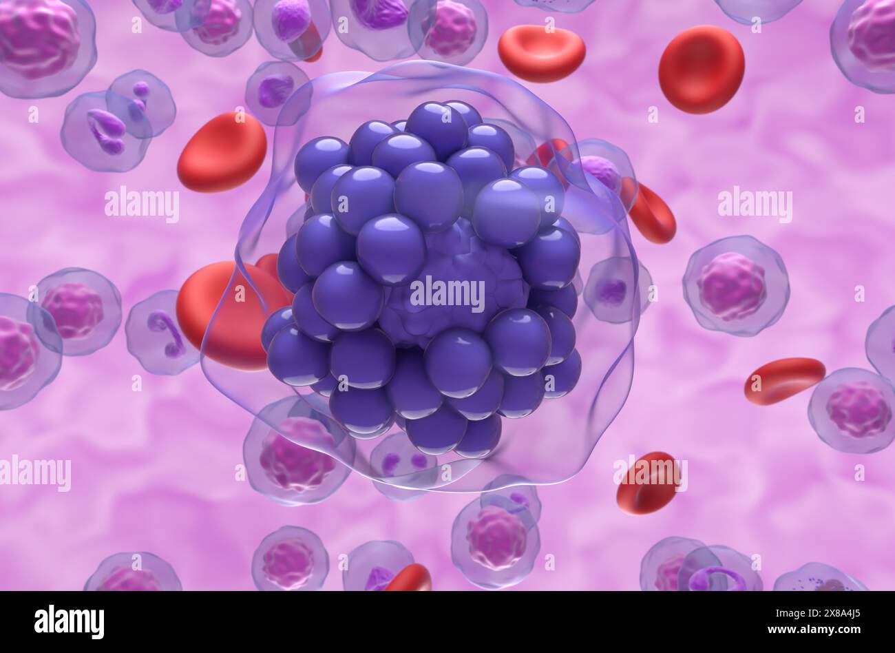 Linfoma diffuso a grandi cellule B (DLBCL) - Vista ravvicinata illustrazione 3d. Foto Stock