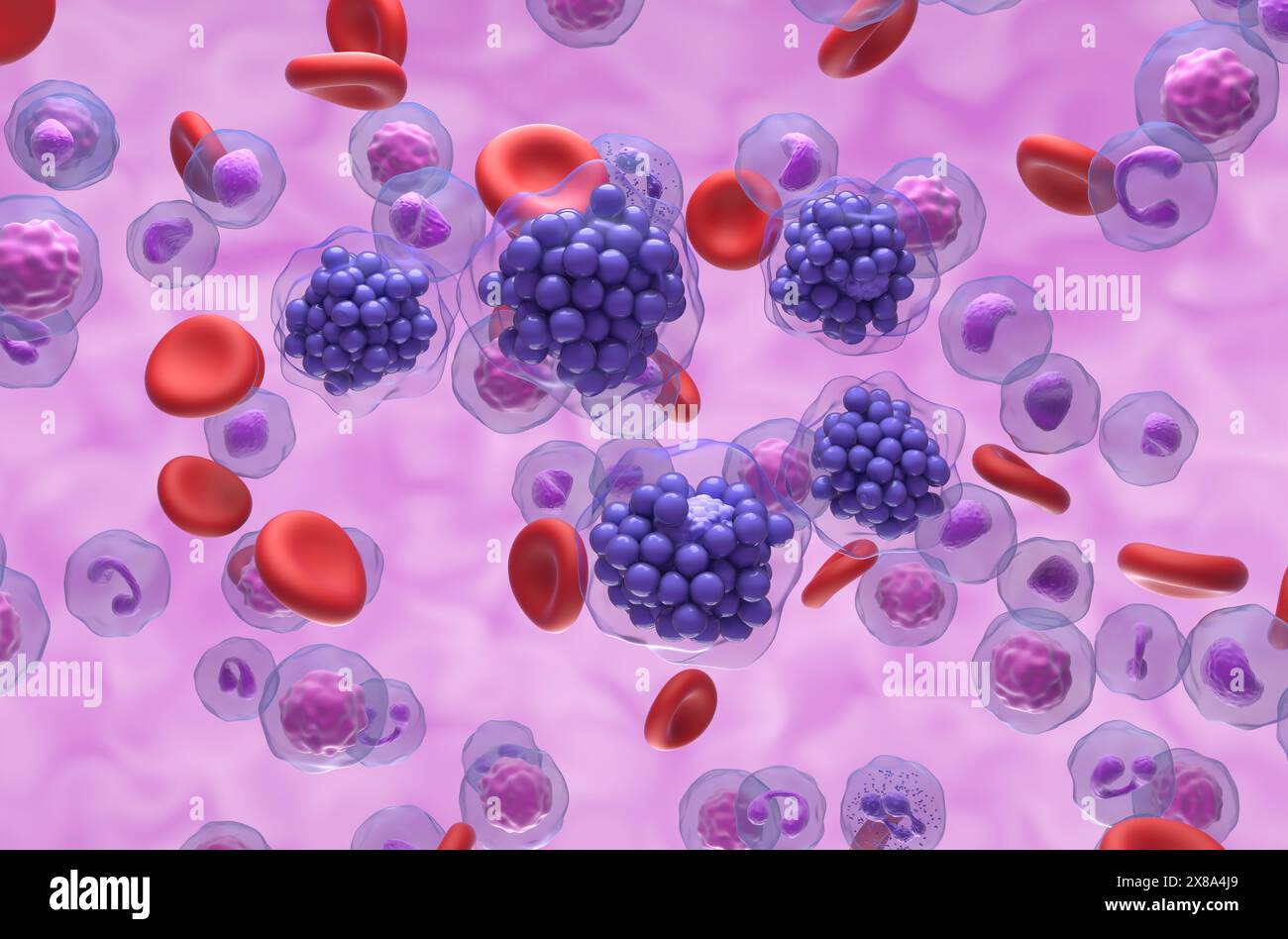 Linfoma diffuso a grandi cellule B (DLBCL) - Vista isometrica illustrazione 3d. Foto Stock