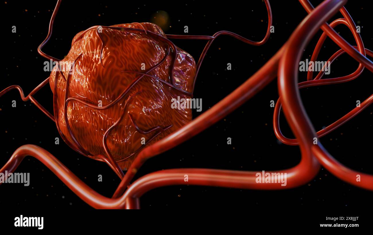 il rendering 3d del cancro richiede un apporto di sangue per fornire i nutrienti e l'ossigeno necessari per crescere e sopravvivere Foto Stock