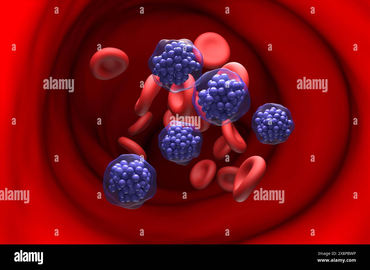 Linfoma diffuso a grandi cellule B (DLBCL) - Vista in sezione illustrazione 3d. Foto Stock