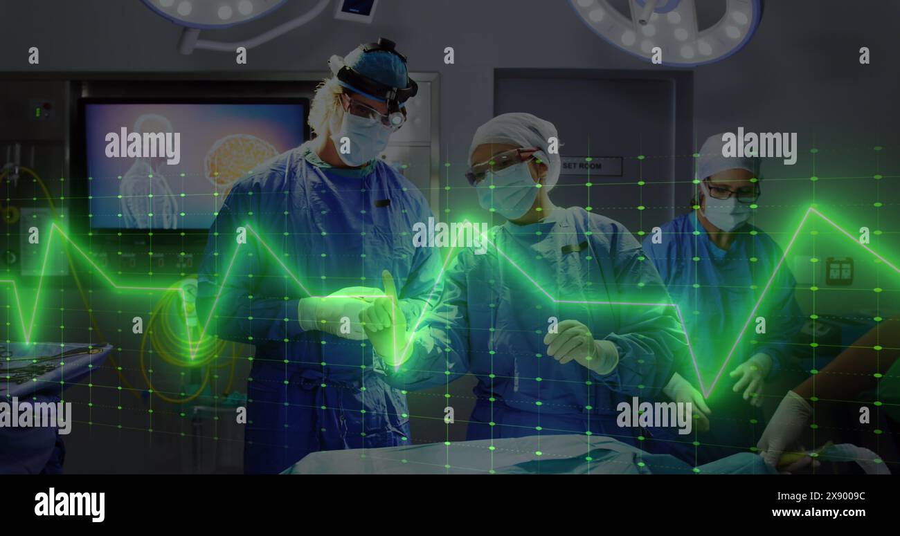 Immagine del cardiofrequenzimetro in confronto a diversi chirurghi maschili e femminili che discutono prima dell'intervento chirurgico Foto Stock