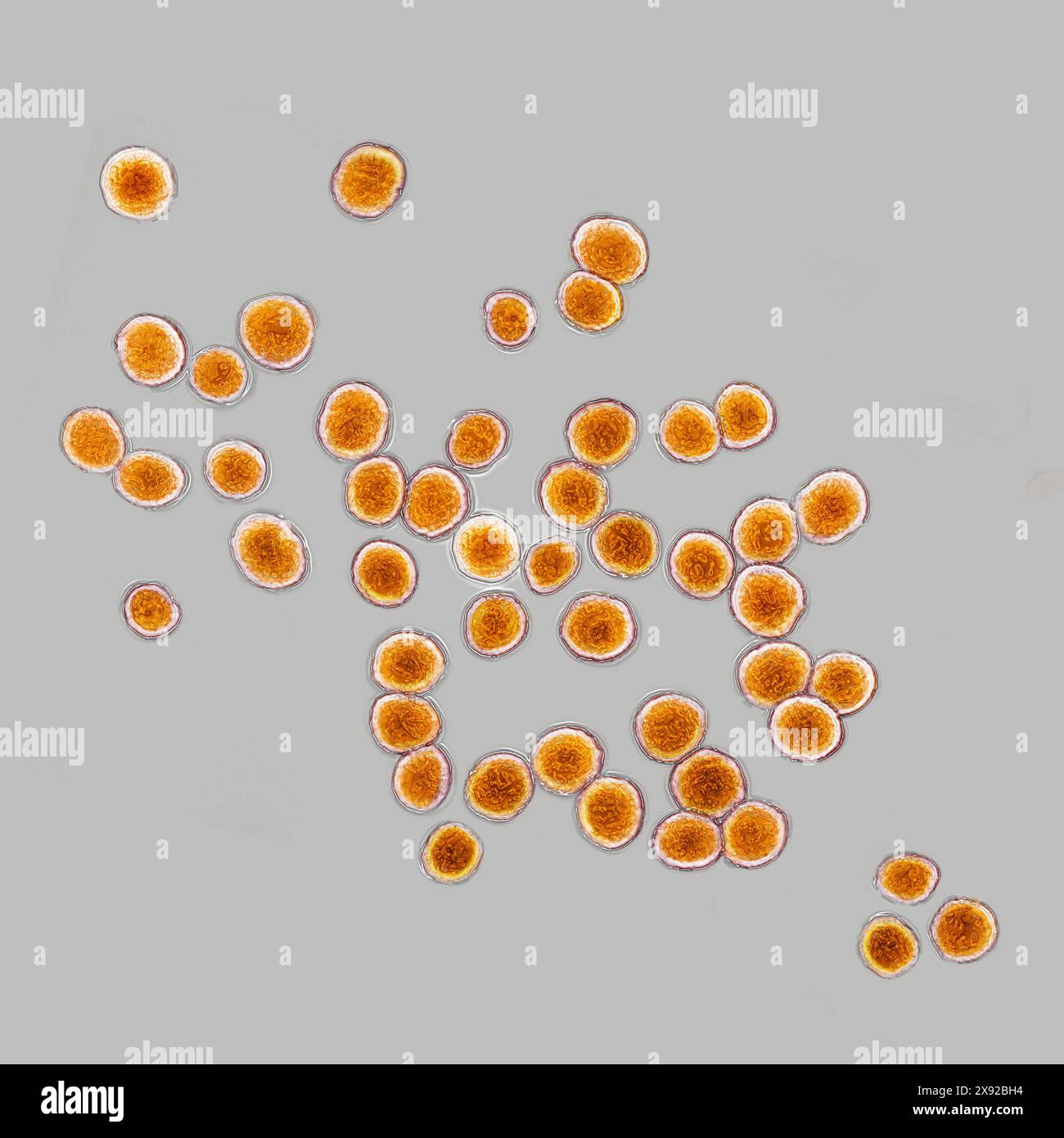 Stafilococchi Staphylococcus pyogenes aureus, batteri responsabili dell'intossicazione alimentare, infezioni suppurative localizzate, infezioni nosocomiali e, in alcuni casi estremi, setticemia. Immagine prodotta da microscopia ottica. Staphylococcus aureus 016813 047 Foto Stock