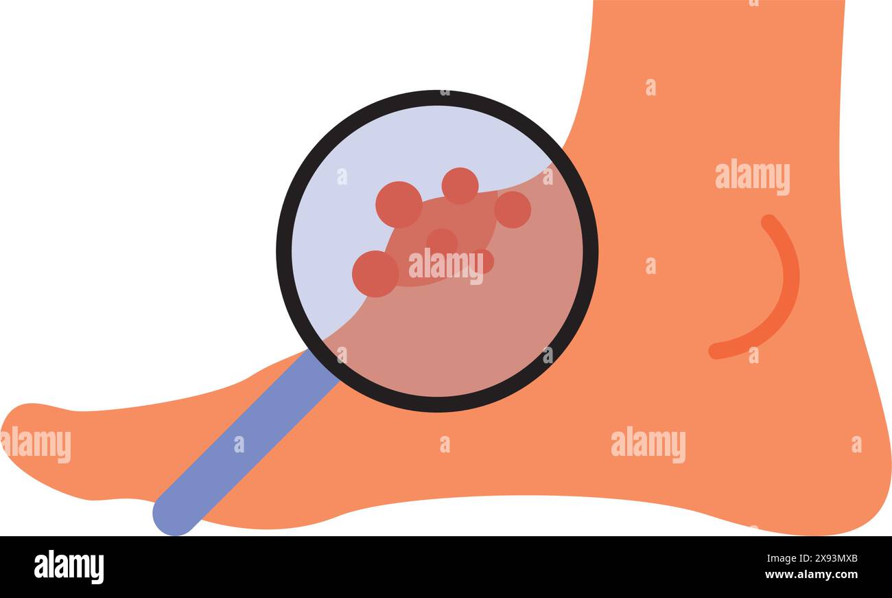 Icona edema delle gambe, diabete e piede, gonfiore delle gambe Illustrazione Vettoriale