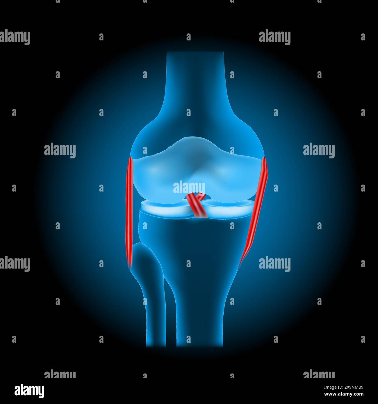lesioni ai legamenti del ginocchio. Giunto del ginocchio umano blu trasparente realistico con effetto luminoso su sfondo scuro. Illustrazione vettoriale come immagine a raggi X. Illustrazione Vettoriale