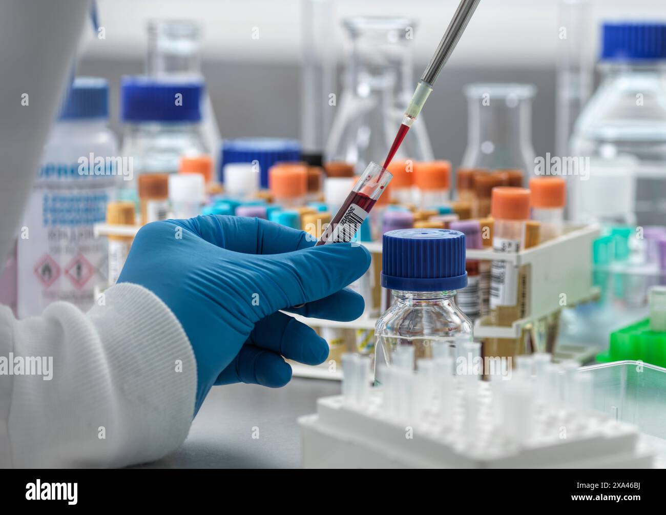 Consegnare il guanto pipettando il campione di sangue in laboratorio Foto Stock