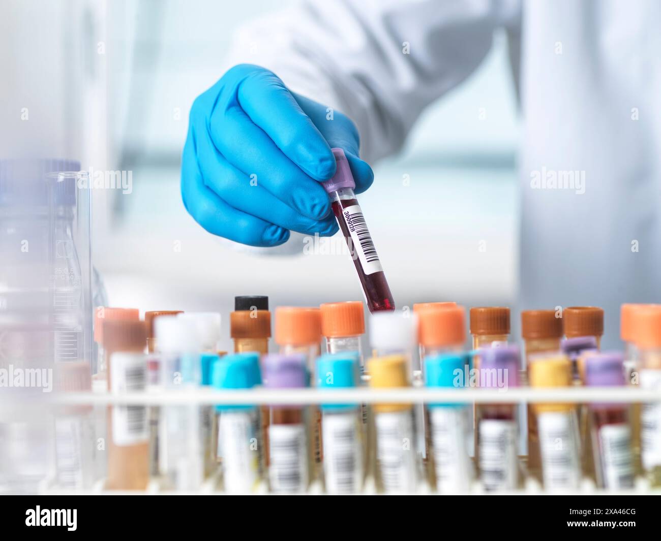 Scienziato che maneggia un campione di sangue in un laboratorio Foto Stock