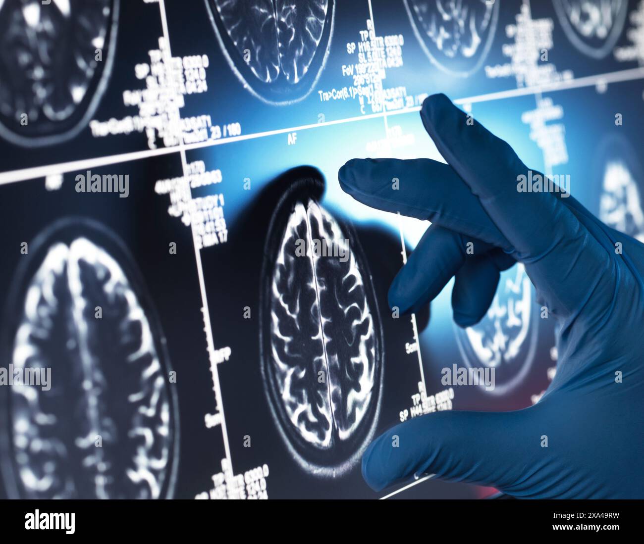 Neurology Research, Dottore che esamina una scansione del cervello umano sullo schermo Foto Stock