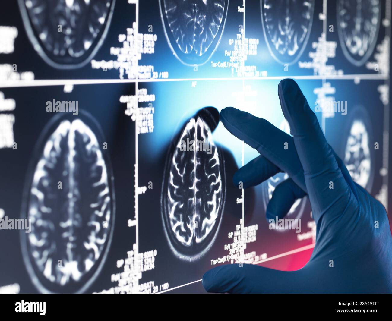 Neurology Research, Dottore che esamina una scansione del cervello umano sullo schermo Foto Stock