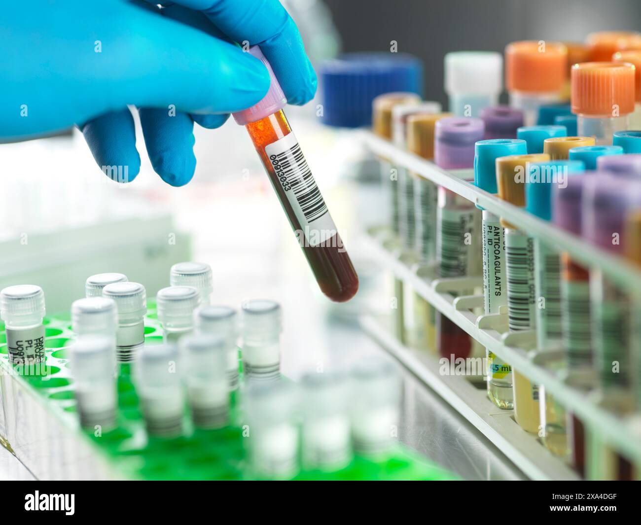 Screening medico, scienziato preparazione di un campione di sangue per l'analisi automatizzata in laboratorio Foto Stock
