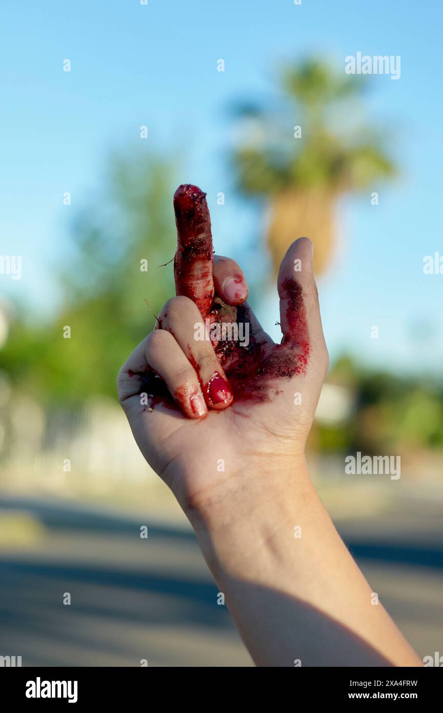 Primo piano di una mano con il sangue sulle dita appoggiata su uno sfondo sfocato con una palma. Foto Stock