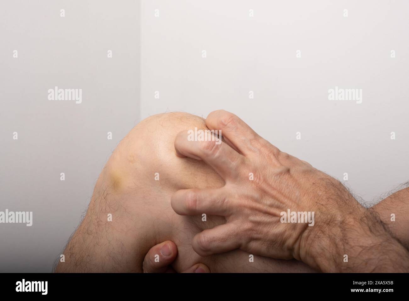 Uomo che gratta tra ginocchio e gamba. Malattia della pelle. Reazione allergica. Dermatologia. Isolato su sfondo bianco. Foto Stock