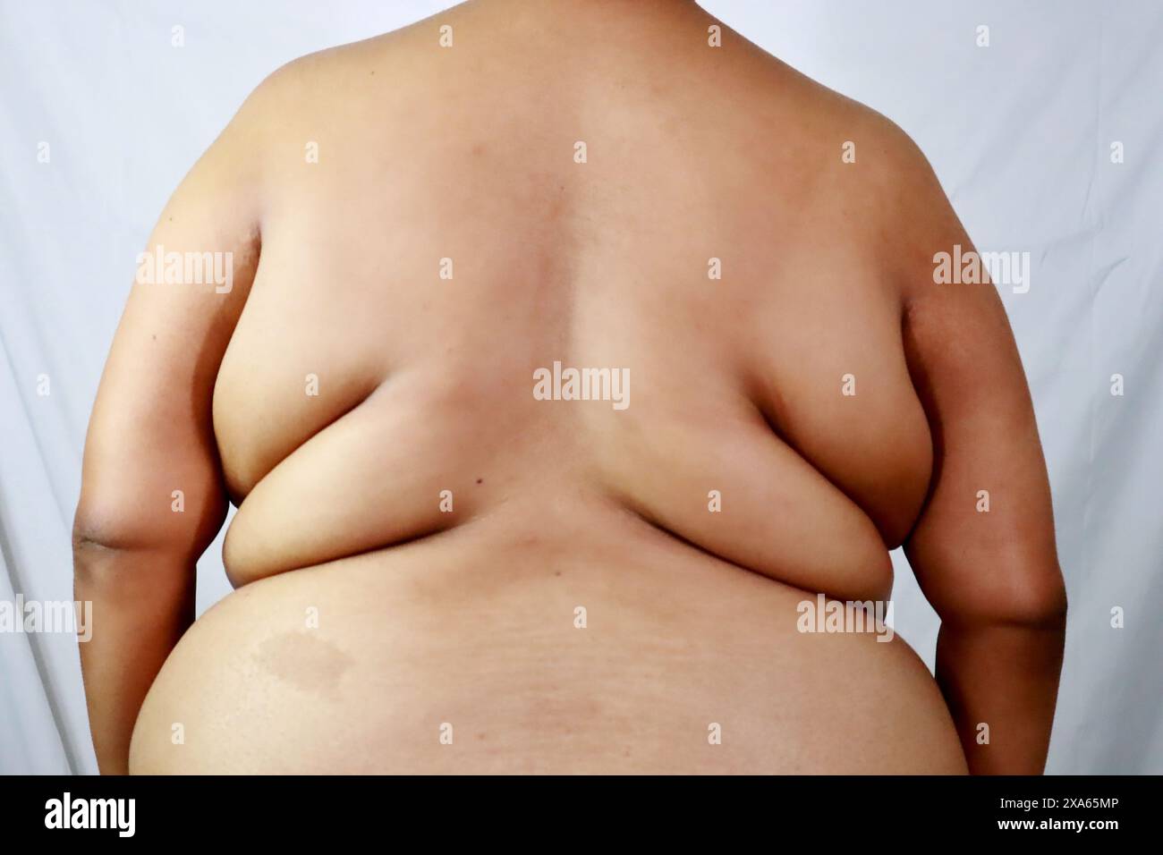 Obese american back view immagini e fotografie stock ad alta risoluzione -  Alamy