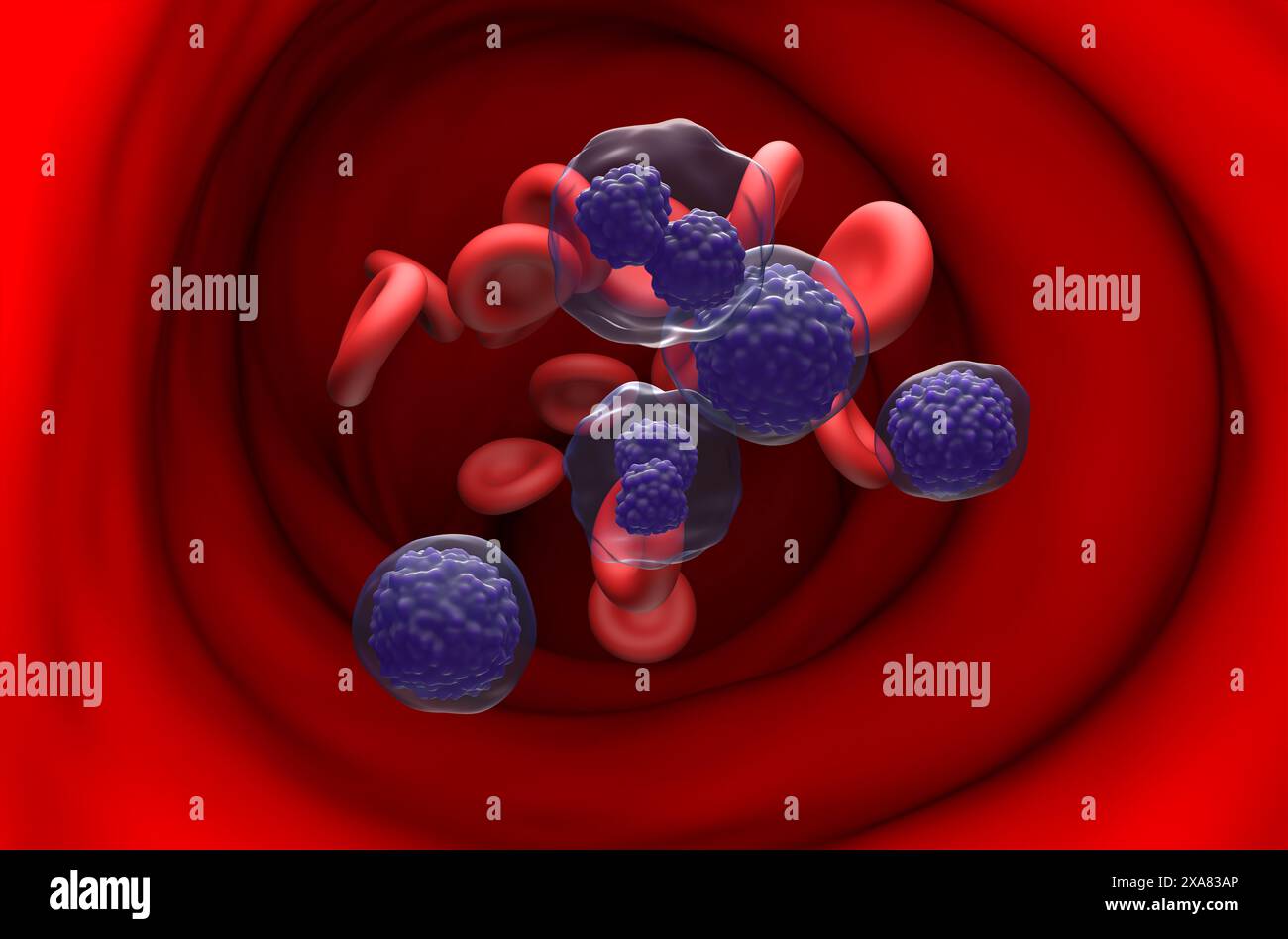 Leucemia plasmacellulare (PCL) - Vista in sezione illustrazione 3d. Foto Stock