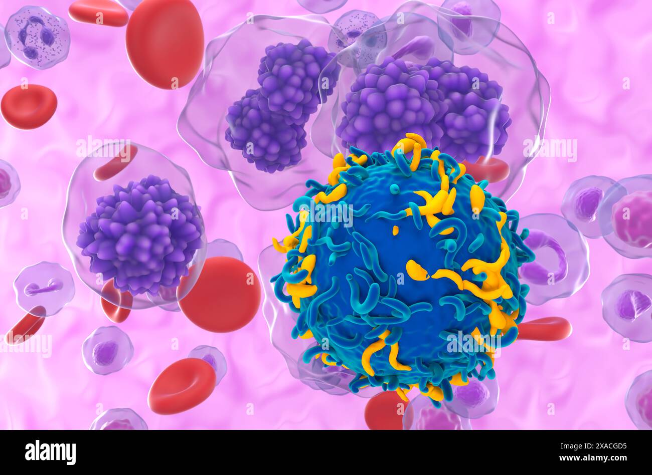 Terapia a cellule T CAR nella leucemia a cellule del plasma (PCL) - Vista ravvicinata illustrazione 3d. Foto Stock