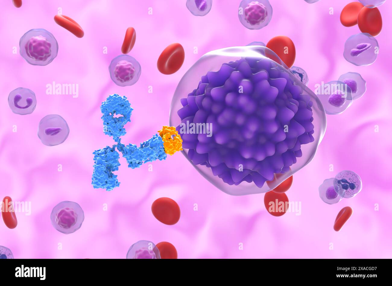 Trattamento con anticorpi monoclonali nella leucemia a cellule del plasma (PCL) - Vista ravvicinata illustrazione 3d. Foto Stock