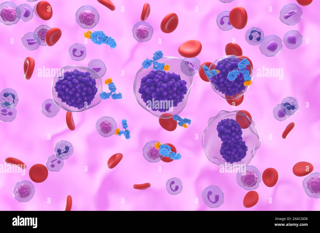 Trattamento con anticorpi monoclonali nella leucemia a cellule di plasma (PCL) - Vista isometrica illustrazione 3d. Foto Stock