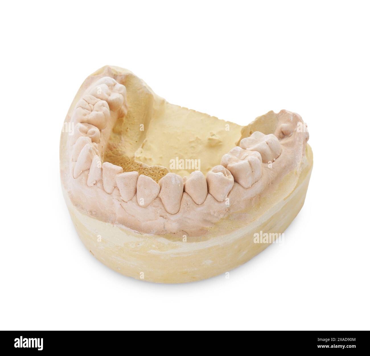 Modello dentale con mascella isolata su bianco. Fusione di denti Foto Stock