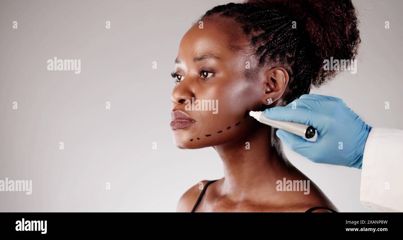 Trasformazione attraverso Facelift Surgery: La precisione di un chirurgo che ripristina giovinezza e bellezza in una giovane donna afroamericana. Foto Stock