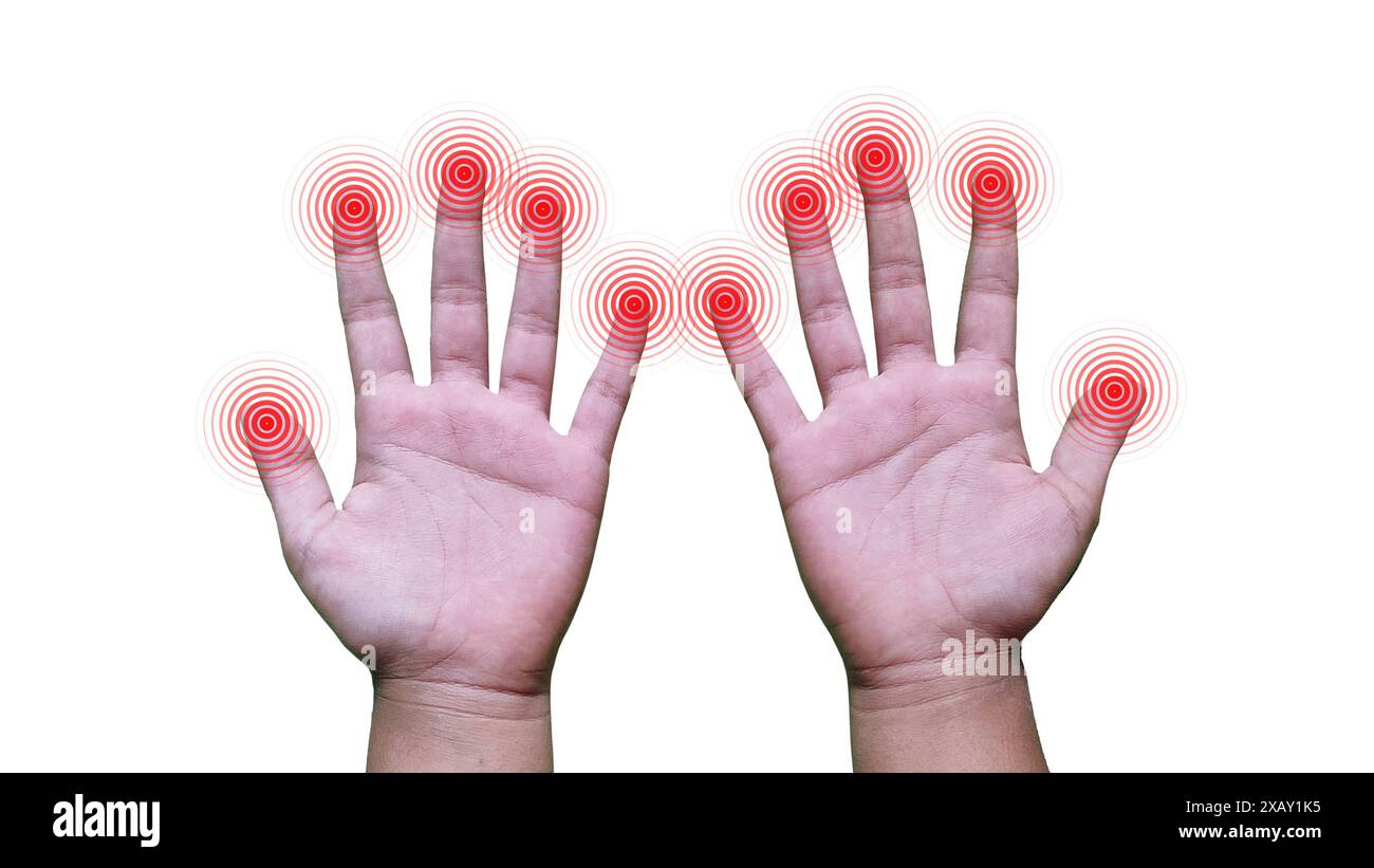 Sindrome da impingement Immagini senza sfondo e Foto Stock ritagliate