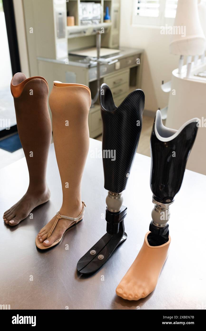 Sul tavolo sono mostrate quattro gambe protesiche con design e materiali diversi. Lo sfondo mostra un laboratorio pulito e ben organizzato con varie attrezzature Foto Stock