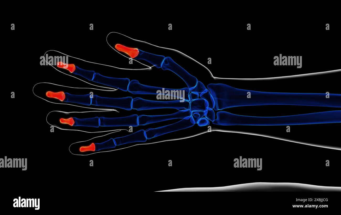 Scheletro umano mano falangi distali anatomia ossea per il concetto medico illustrazione 3D. Foto Stock