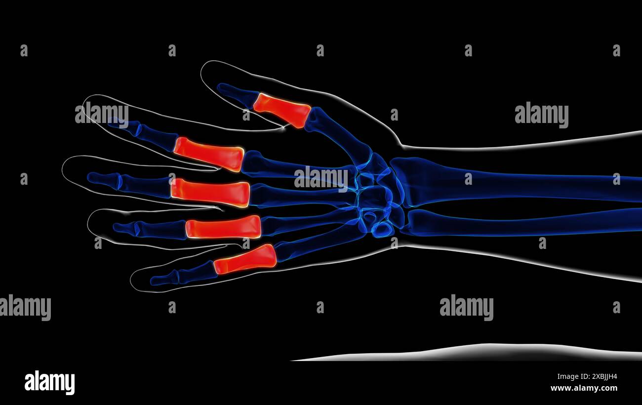 Illustrazione 3D dell'anatomia delle falangi prossimali dello scheletro umano Foto Stock