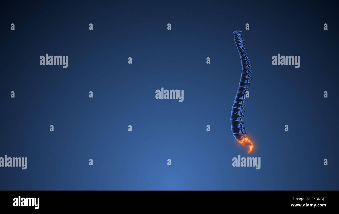 Concetto medico di dolore sacro umano Foto Stock