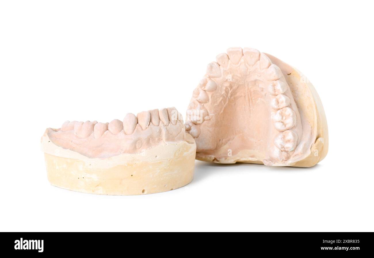 Modello dentale con mascelle isolate su bianco. Fusione di denti Foto Stock