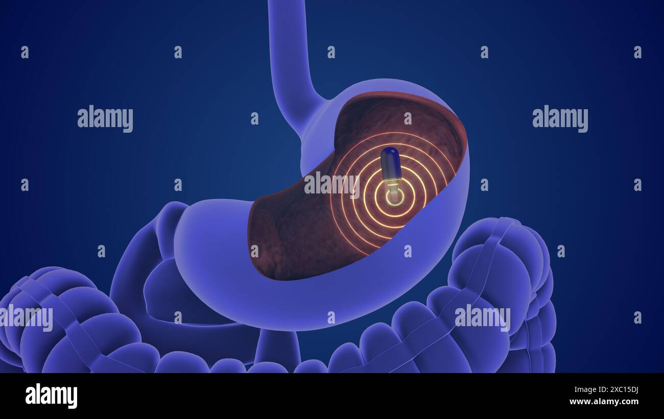 Trasmissione wireless ed endoscopia delle capsule Foto Stock