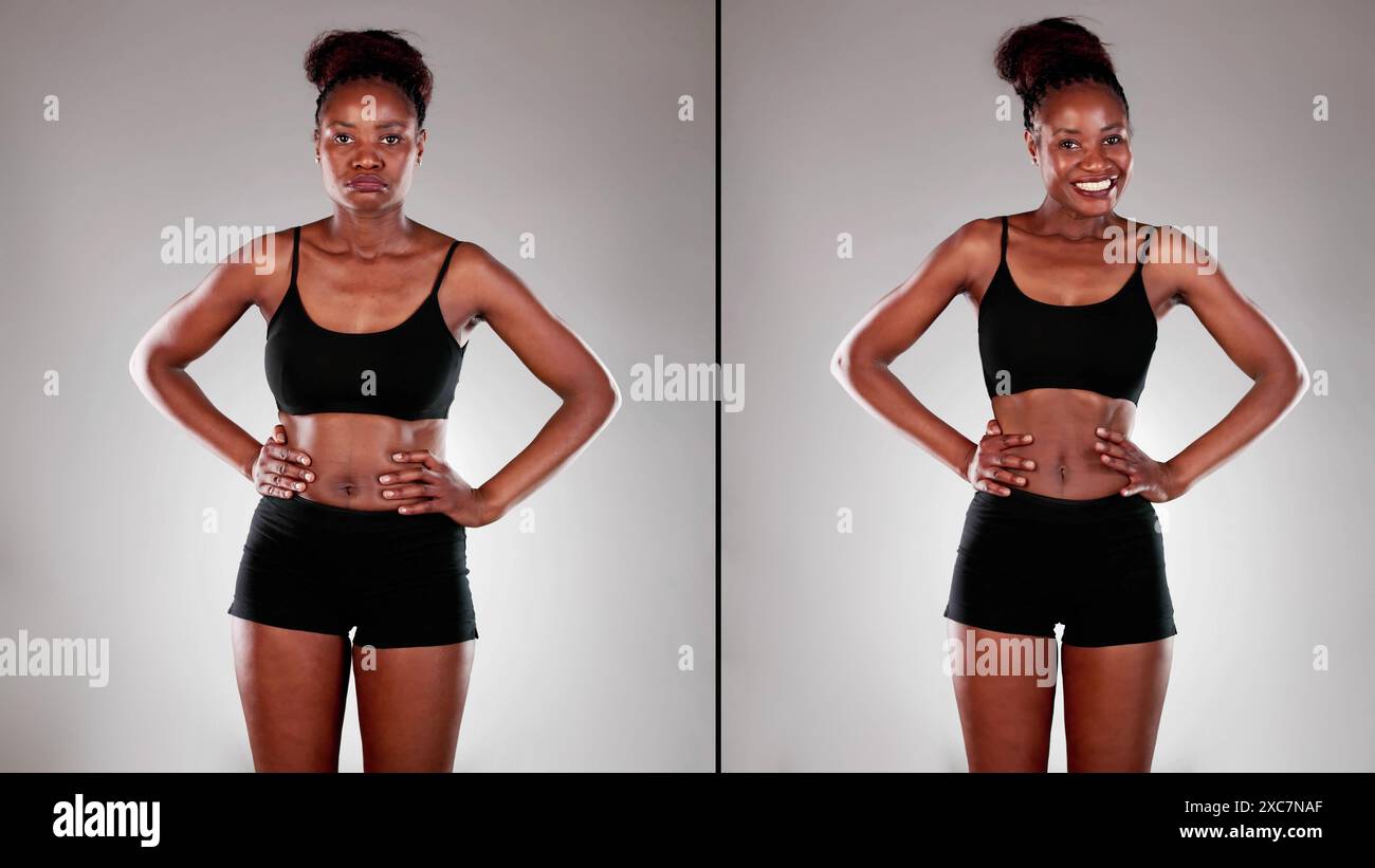Trasformazione: Dall'obesità al fitness - il viaggio di una donna afroamericana attraverso la perdita di peso e il successo della chirurgia liposuzione. Foto Stock